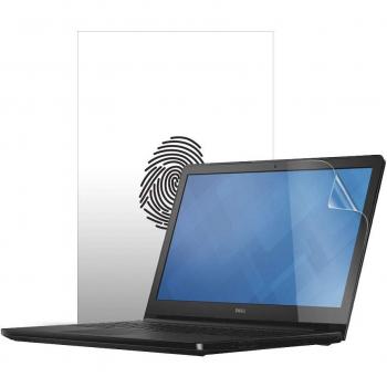 Celicious Vivid Plus Mild Anti-Glare Screen Protector for Dell Inspiron 15 5565 (Non-Touch) [Pack of 2]