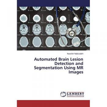 Nabizadeh, Nooshin: Automated Brain Lesion Detection and Segmentation Using MR Images