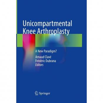 Unicompartmental Knee Arthroplasty
