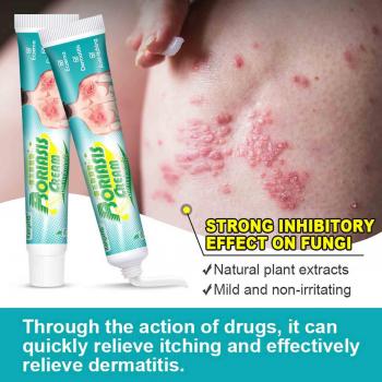 Mardi Gra Cremilla Psoriasis y Sudor