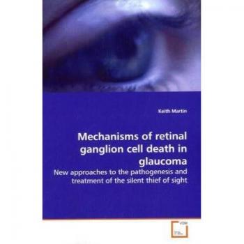 Mechanisms of retinal ganglion cell death in glaucoma