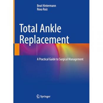 Total Ankle Replacement